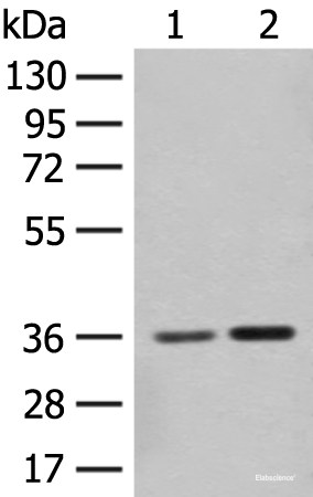 Western blot analysis of Mouse brain tissue and Rat brain tissue lysates  using SLC25A27 Polyclonal Antibody at dilution of 1:350