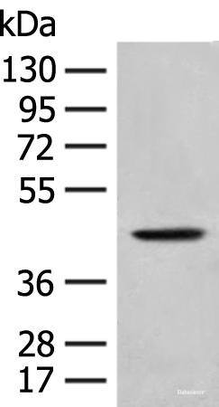 Western blot analysis of A549 cell lysate  using HLA-B Polyclonal Antibody at dilution of 1:400