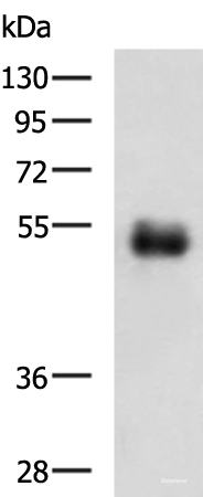 Western blot analysis of Human colorectal cancer tissue lysate  using METTL17 Polyclonal Antibody at dilution of 1:700