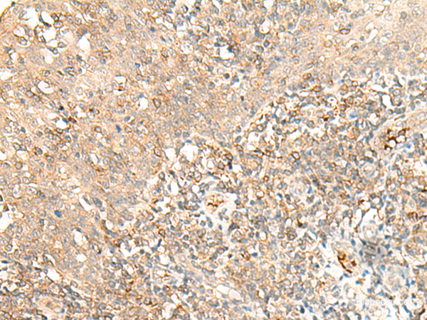 Immunohistochemistry of paraffin-embedded Human tonsil tissue  using MOB3B Polyclonal Antibody at dilution of 1:40(×200)
