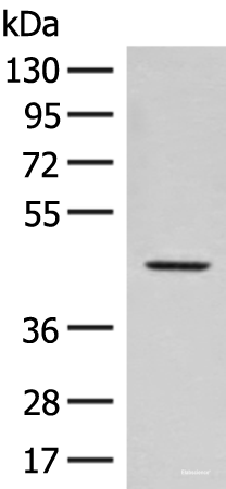 Western blot analysis of Hela cell lysate  using FAM50A Polyclonal Antibody at dilution of 1:300