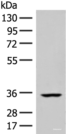 Western blot analysis of Human heart tissue lysate  using FBXO16 Polyclonal Antibody at dilution of 1:400