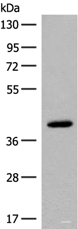 Western blot analysis of Human placenta tissue lysate  using FCGRT Polyclonal Antibody at dilution of 1:400
