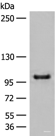 Western blot analysis of HEPG2 cell lysate  using CTDP1 Polyclonal Antibody at dilution of 1:500