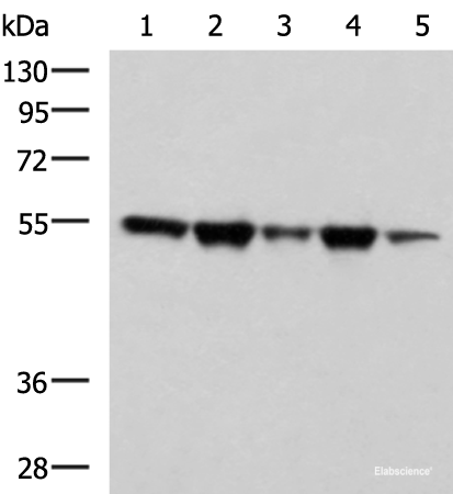 Western blot analysis of A172 Hela HepG2 K562 and PC3 cell lysates  using FKBP5 Polyclonal Antibody at dilution of 1:600
