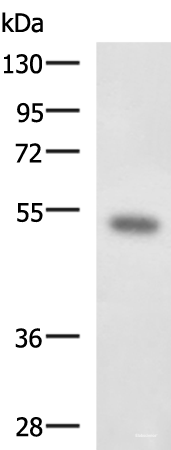 Western blot analysis of Mouse kidney tissue lysate  using FOXQ1 Polyclonal Antibody at dilution of 1:650