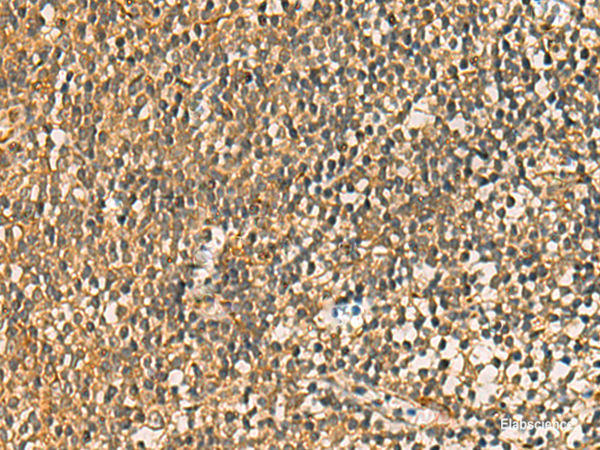 Immunohistochemistry of paraffin-embedded Human tonsil tissue  using FAAP100 Polyclonal Antibody at dilution of 1:50(×200)