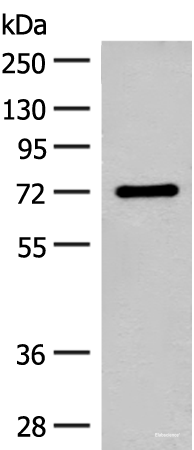 Western blot analysis of Rat brain tissue lysate  using SLC6A11 Polyclonal Antibody at dilution of 1:500