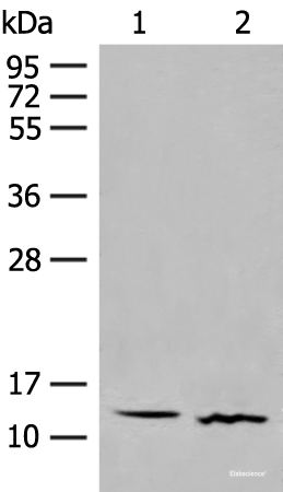 Western blot analysis of Human fetal brain tissue and Mouse thymus tissue lysates  using GALP Polyclonal Antibody at dilution of 1:500