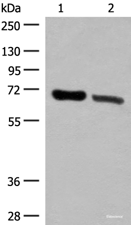 Western blot analysis of Human placenta tissue and Human fetal brain tissue lysates  using TRIM8 Polyclonal Antibody at dilution of 1:500