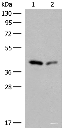 Western blot analysis of Hela and HEPG2 cell lysates  using GIPC1 Polyclonal Antibody at dilution of 1:400