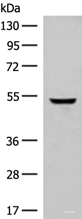 Western blot analysis of Human cerebella tissue lysate  using GLCCI1 Polyclonal Antibody at dilution of 1:400