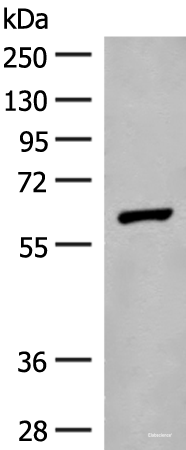 Western blot analysis of Mouse liver tissue lysate  using GLS2 Polyclonal Antibody at dilution of 1:400