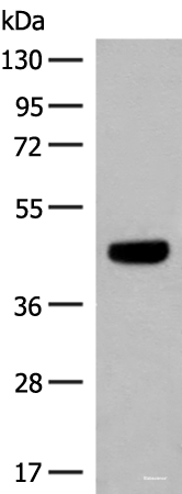 Western blot analysis of HT29 cell lysate  using GNAT1 Polyclonal Antibody at dilution of 1:250