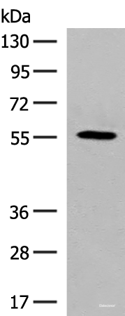 Western blot analysis of HepG2 cell lysate  using GPR22 Polyclonal Antibody at dilution of 1:500