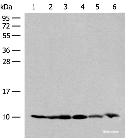 Western blot analysis of 293T and PC3 cell Mouse spleen tissue 231 cell Human breast cancer tissue Mouse kidney tissue lysates  using RPS28 Polyclonal Antibody at dilution of 1:200
