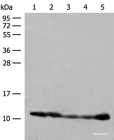 Western blot analysis of 293T cell PC-3 cell Human liver tissue lysates  using ATP5I Polyclonal Antibody at dilution of 1:400