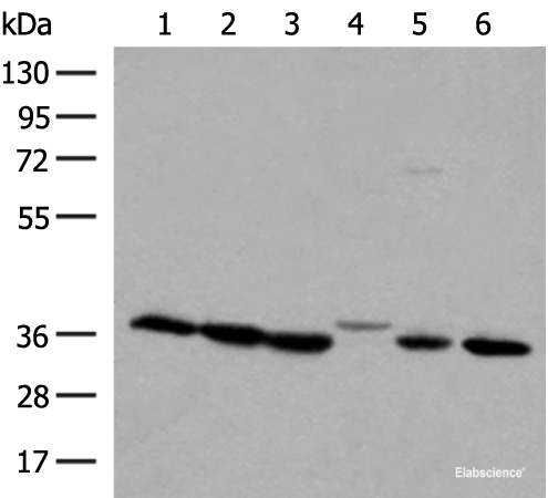 Western blot analysis of 293T and A375 cell lysates  using LDHA Polyclonal Antibody at dilution of 1:250