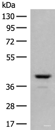 Western blot analysis of Human fetal brain tissue lysate  using TAAR2 Polyclonal Antibody at dilution of 1:350