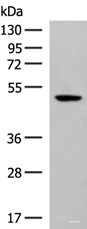 Western blot analysis of Hela cell lysate  using GPR142 Polyclonal Antibody at dilution of 1:400