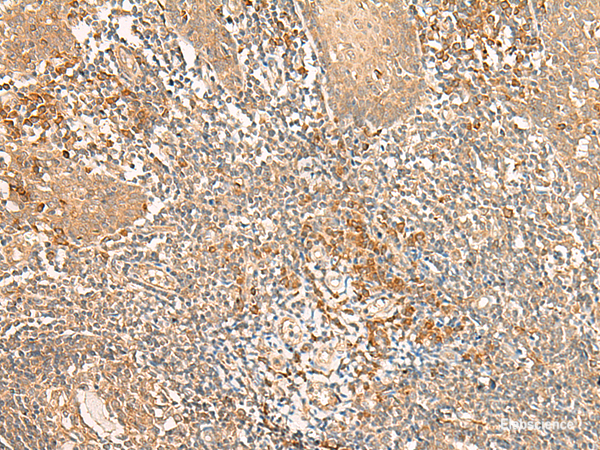 Immunohistochemistry of paraffin-embedded Human tonsil tissue  using WLS Polyclonal Antibody at dilution of 1:50(×200)