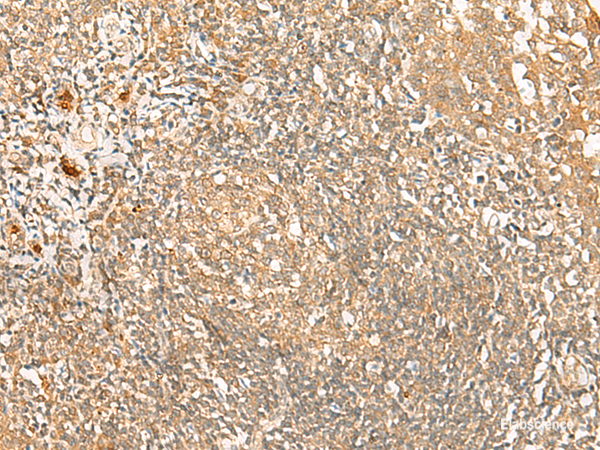 Immunohistochemistry of paraffin-embedded Human tonsil tissue  using PROKR1 Polyclonal Antibody at dilution of 1:40(×200)