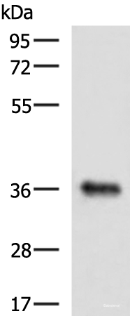 Western blot analysis of Mouse liver tissue lysate  using GRHPR Polyclonal Antibody at dilution of 1:900