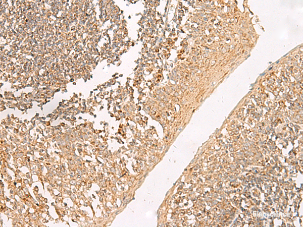Immunohistochemistry of paraffin-embedded Human tonsil tissue  using GRIK5 Polyclonal Antibody at dilution of 1:35(×200)