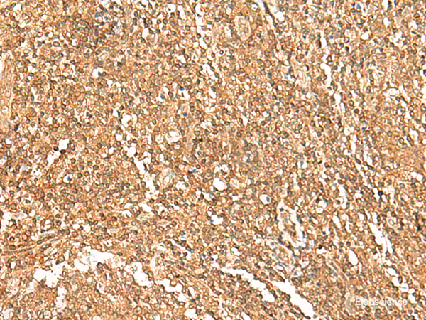 Immunohistochemistry of paraffin-embedded Human tonsil tissue  using GTF3A Polyclonal Antibody at dilution of 1:75(×200)