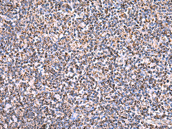 Immunohistochemistry of paraffin-embedded Human tonsil tissue  using HSF2BP Polyclonal Antibody at dilution of 1:30(×200)