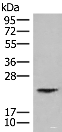 Western blot analysis of Human kidney tissue lysate  using HEBP1 Polyclonal Antibody at dilution of 1:750