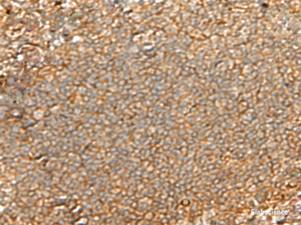 Immunohistochemistry of paraffin-embedded Human tonsil tissue  using GNGT2 Polyclonal Antibody at dilution of 1:40(×200)