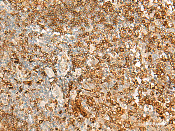 Immunohistochemistry of paraffin-embedded Human tonsil tissue  using HLA-DRB1 Polyclonal Antibody at dilution of 1:35(×200)