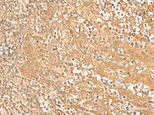Immunohistochemistry of paraffin-embedded Human tonsil tissue  using HMBOX1 Polyclonal Antibody at dilution of 1:30(×200)