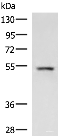 Western blot analysis of Rat liver tissue lysate  using ONECUT1 Polyclonal Antibody at dilution of 1:600