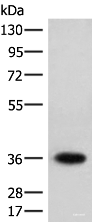 Western blot analysis of Jurkat cell lysate  using HOXC12 Polyclonal Antibody at dilution of 1:500