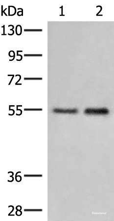 Western blot analysis of Human placenta tissue and 231 cell lysates  using HTRA4 Polyclonal Antibody at dilution of 1:400