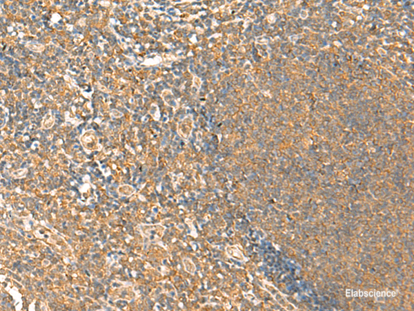 Immunohistochemistry of paraffin-embedded Human tonsil tissue  using HTT Polyclonal Antibody at dilution of 1:25(×200)