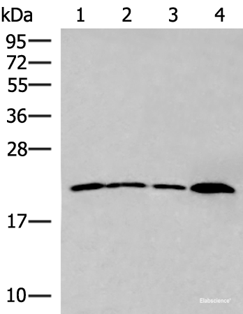 Western blot analysis of 231 cell Human breast cancer tissue Raji cell Human fetal liver tissue lysates  using IFNA5 Polyclonal Antibody at dilution of 1:400