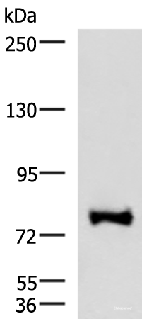 Western blot analysis of TM4 cell lysate  using FOXK2 Polyclonal Antibody at dilution of 1:1000