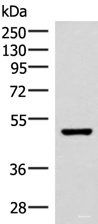 Western blot analysis of Mouse brain tissue lysate  using IP6K2 Polyclonal Antibody at dilution of 1:500