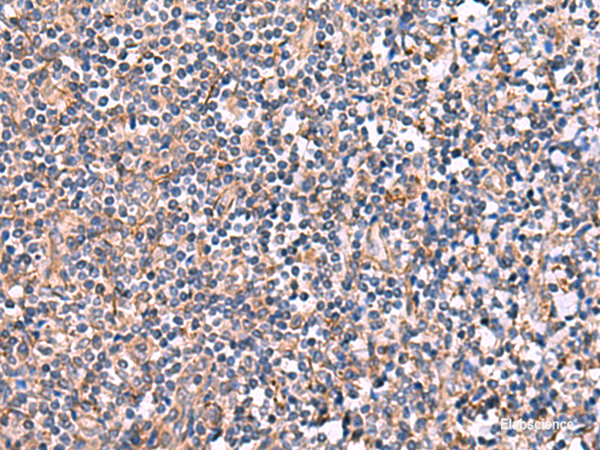 Immunohistochemistry of paraffin-embedded Human tonsil tissue  using INPP5B Polyclonal Antibody at dilution of 1:40(×200)