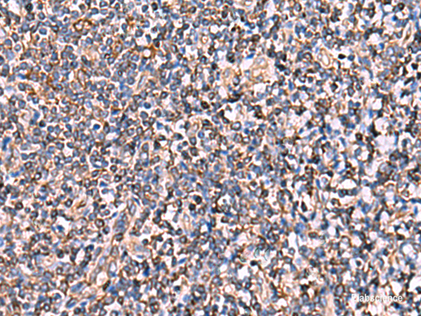 Immunohistochemistry of paraffin-embedded Human tonsil tissue  using INSC Polyclonal Antibody at dilution of 1:65(×200)