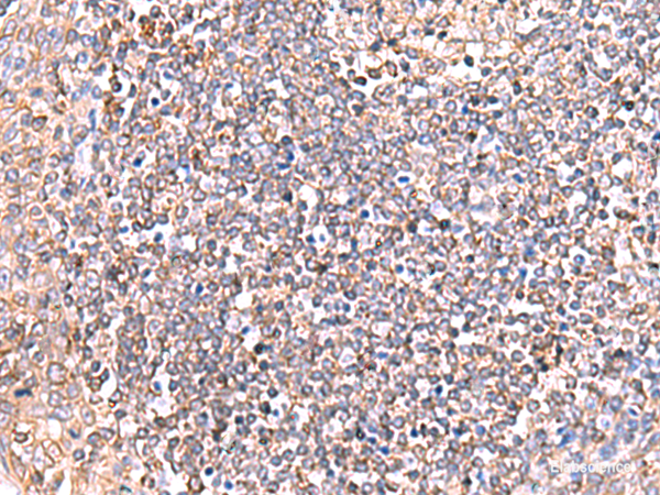 Immunohistochemistry of paraffin-embedded Human tonsil tissue  using GRIA2 Polyclonal Antibody at dilution of 1:50(×200)