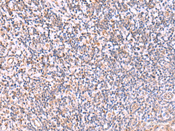 Immunohistochemistry of paraffin-embedded Human tonsil tissue  using ITPKC Polyclonal Antibody at dilution of 1:40(×200)