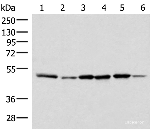 Western blot analysis of Jurkat PC-3 HepG2 Hela HT-29 and Raji cell lysates  using IP6K1 Polyclonal Antibody at dilution of 1:400