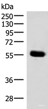 Western blot analysis of Mouse pancreas tissue lysate  using IPPK Polyclonal Antibody at dilution of 1:350