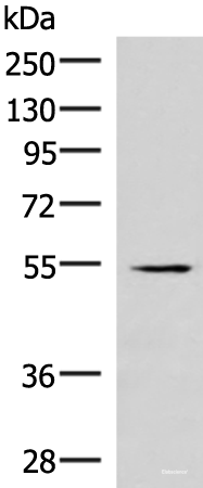 Western blot analysis of Human heart tissue lysate  using IRX1 Polyclonal Antibody at dilution of 1:300
