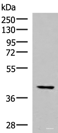 Western blot analysis of Hela cell lysate  using IST1 Polyclonal Antibody at dilution of 1:1000