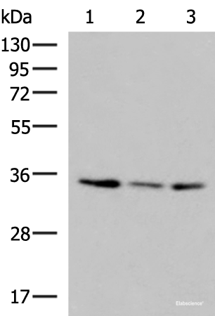 Western blot analysis of HepG2 HL60 cell Human fetal liver tissue lysates  using ISY1-RAB43 Polyclonal Antibody at dilution of 1:1000